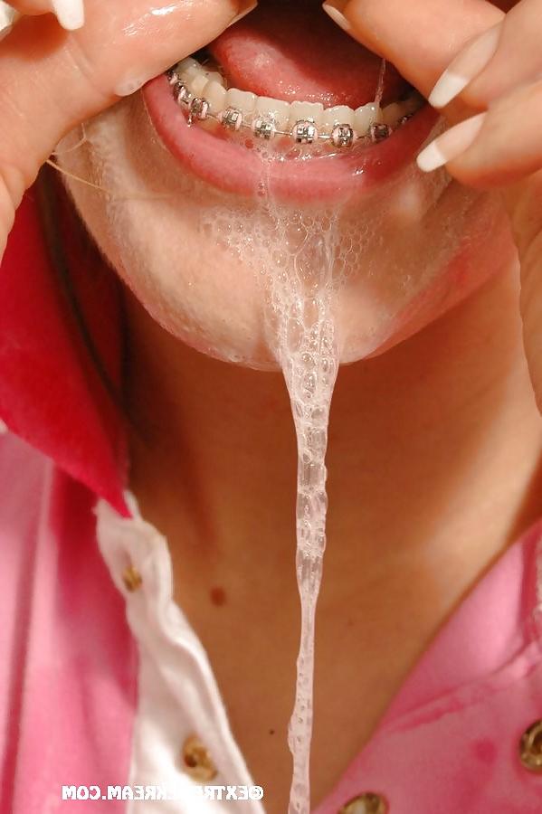 12P Cum Braces..