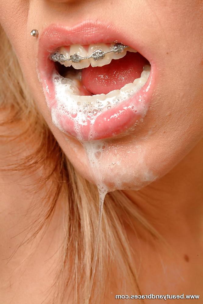 12P Cum Braces..