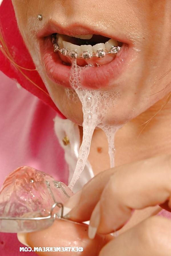 12P Cum Braces..
