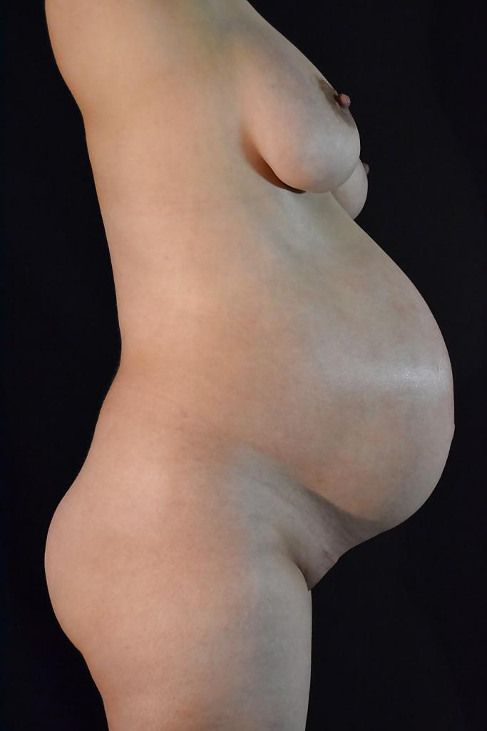 11P Pregnant mother