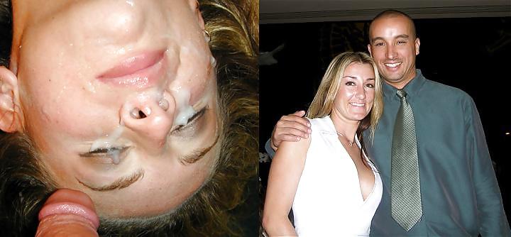 11P Before After