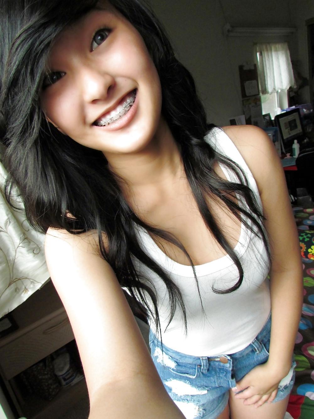 25P Teenager mit Zahnspange 4