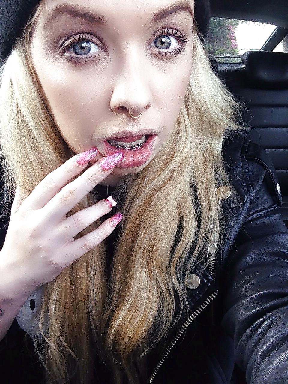 25P Teenager mit Zahnspange 4