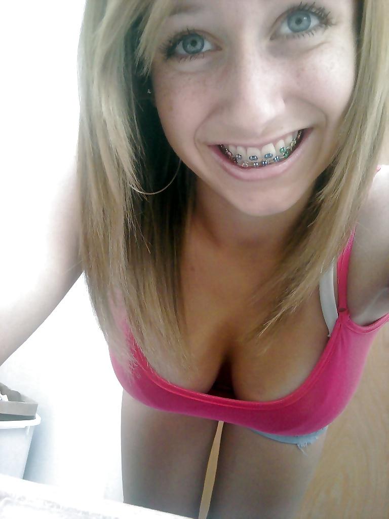 25P Teenager mit Zahnspange 4