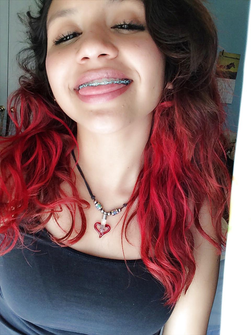 25P Teenager mit Zahnspange 4