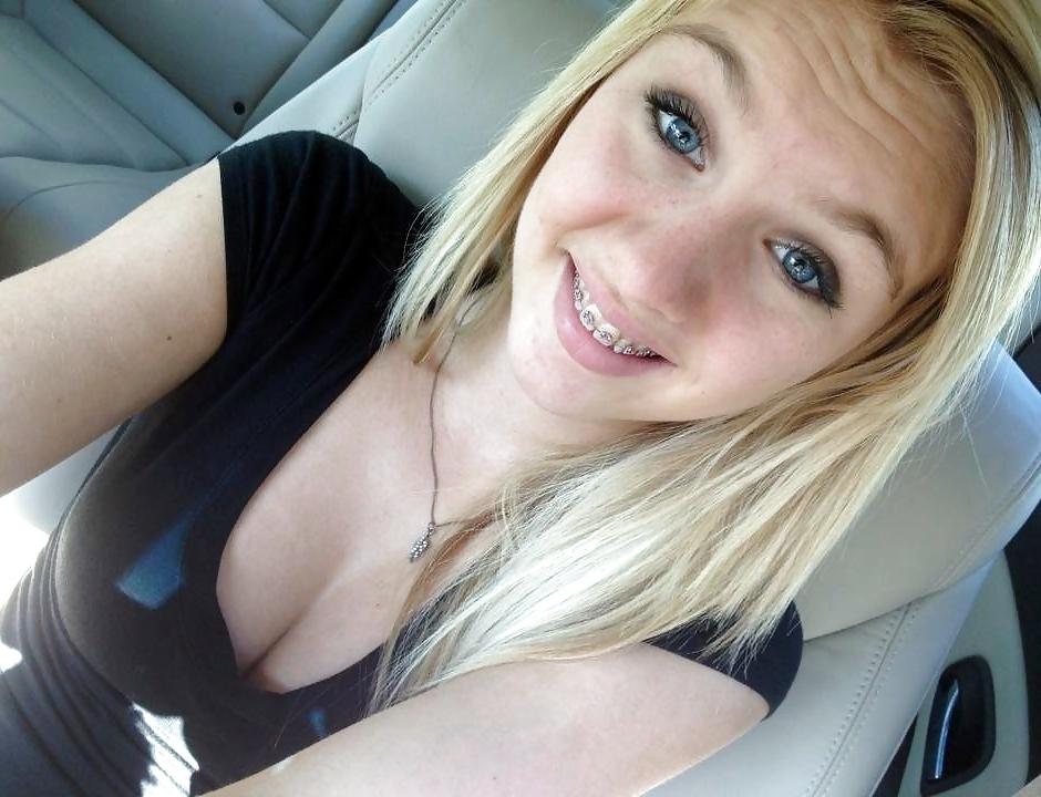 25P Teenager mit Zahnspange 4
