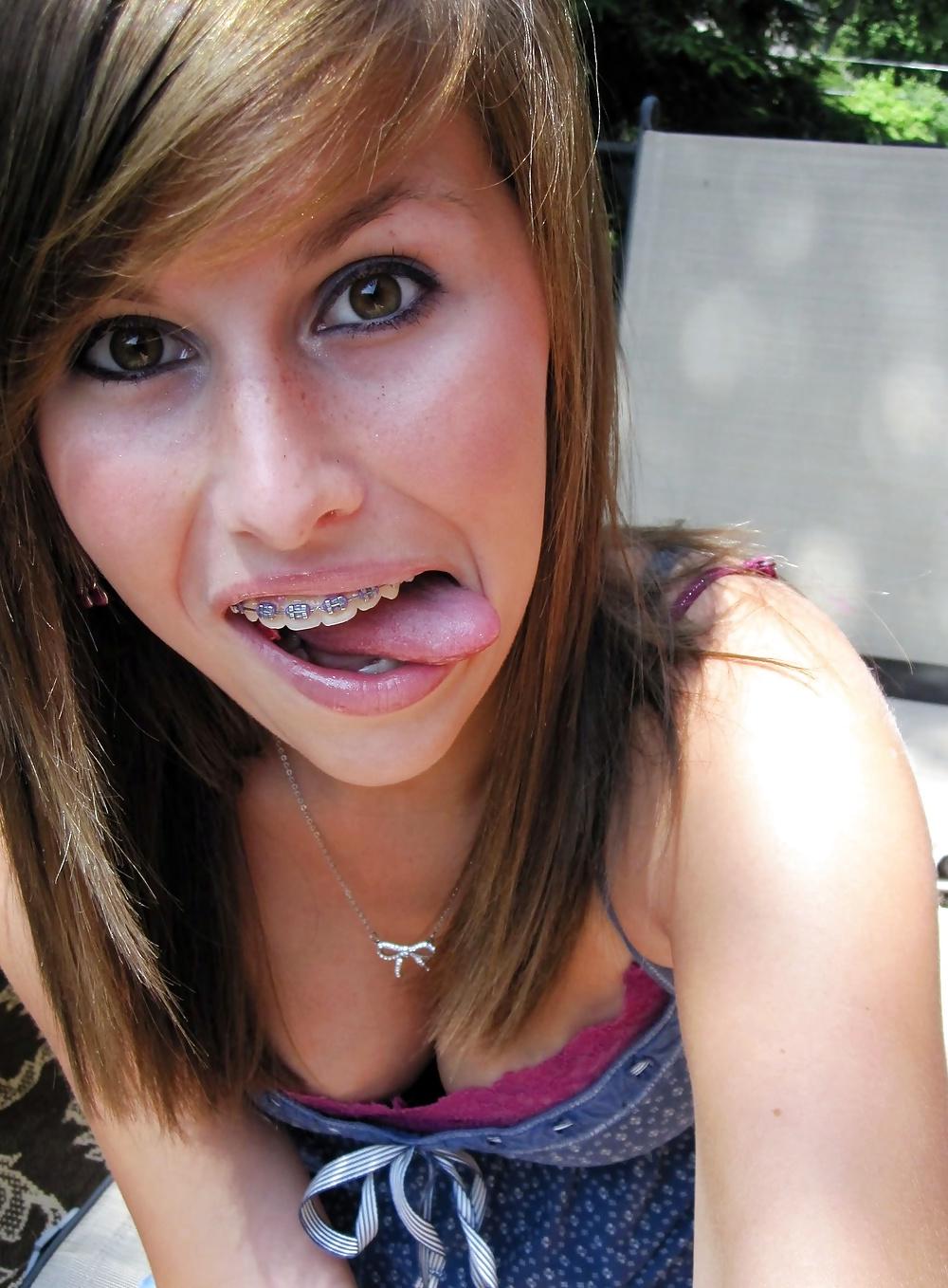 25P Teenager mit Zahnspange 4
