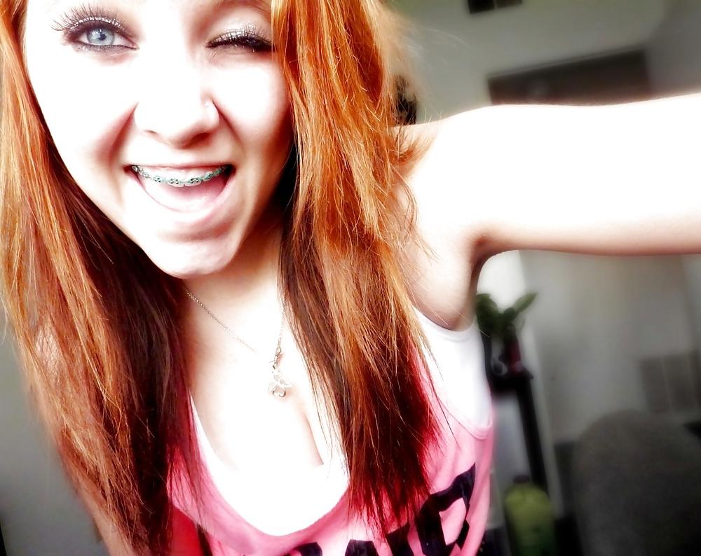 25P Teenager mit Zahnspange 4