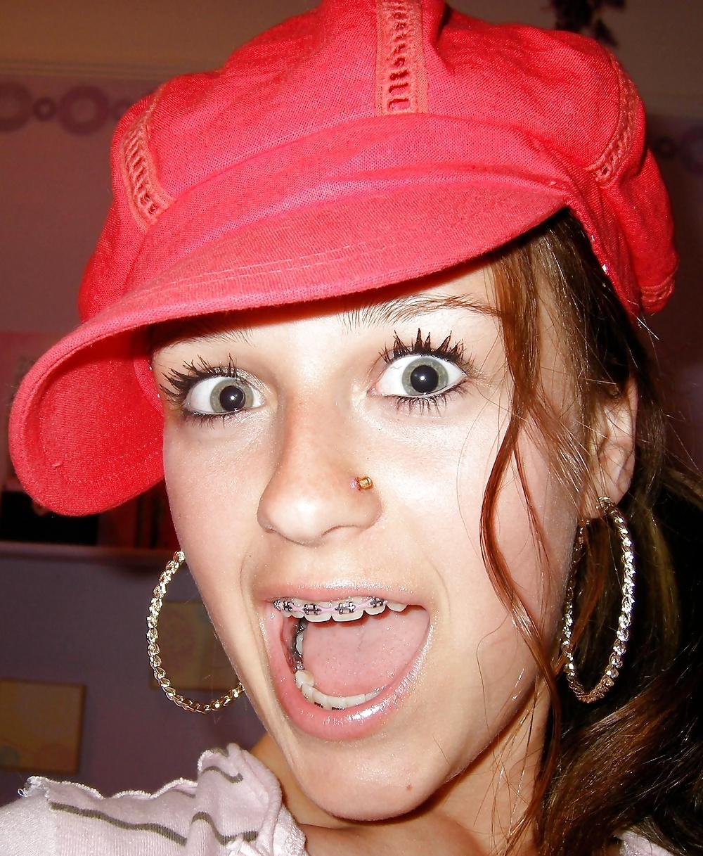 25P Teenager mit Zahnspange 4