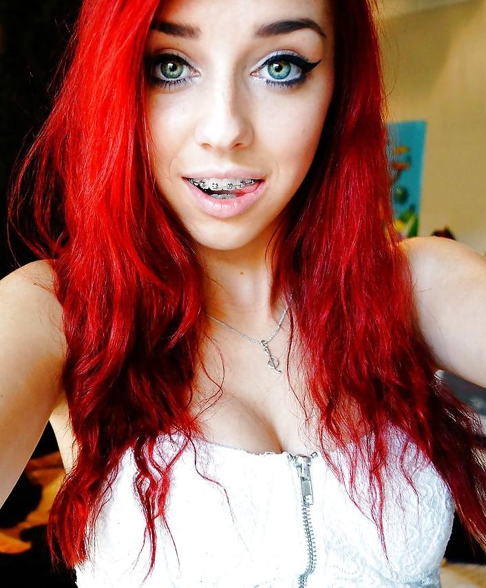 25P Teenager mit Zahnspange 4