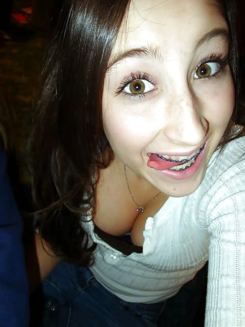 25P Teenager mit Zahnspange 4
