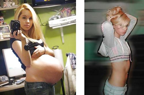 25P Pregnant 10