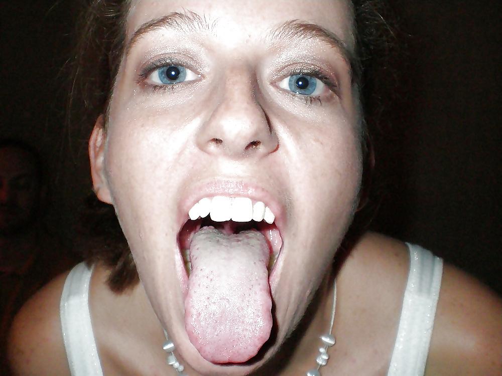 25P Mouth Open