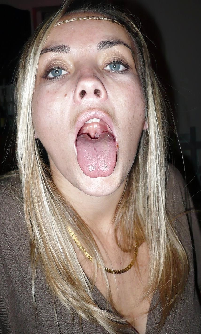 25P Mouth Open