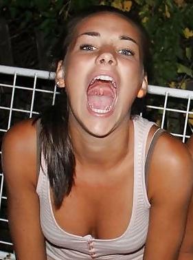 25P Mouth Open