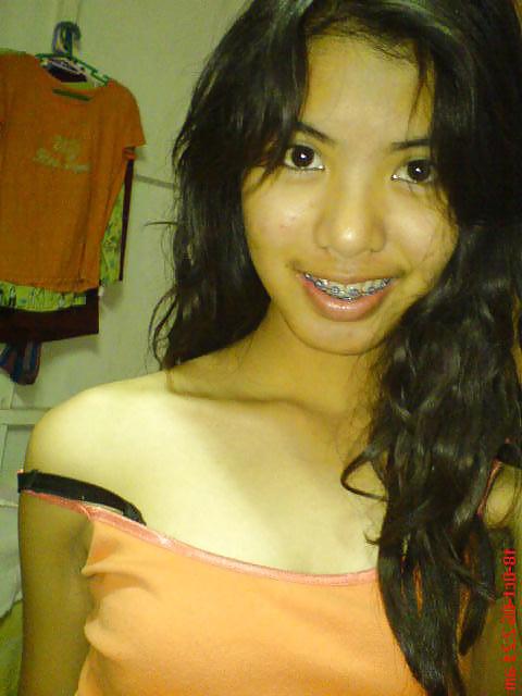 15P Gadis Melayu - Braces