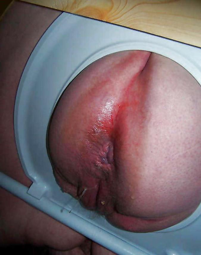 25P Gape ass