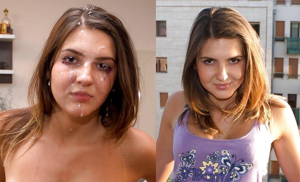 25P Unwanted Facials
