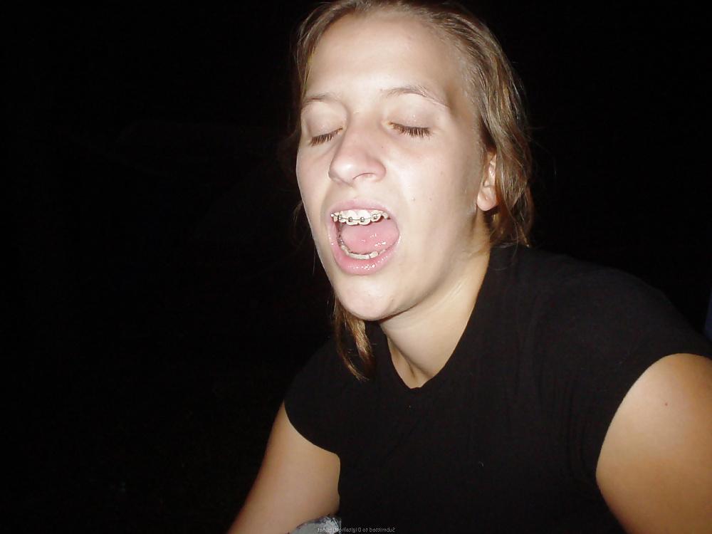 25P Guys Braces Girlfriend 