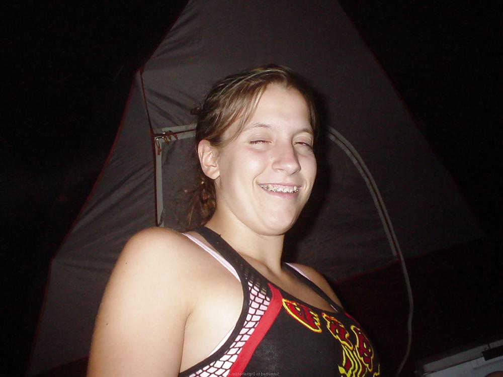 25P Guys Braces Girlfriend 