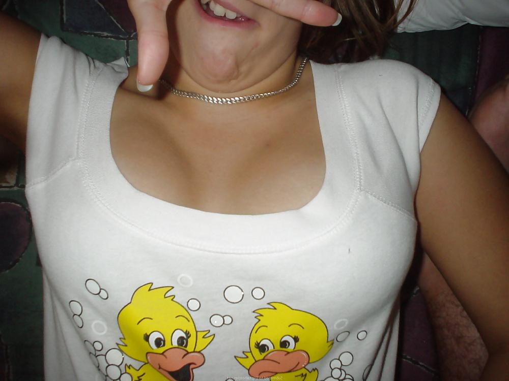 25P Guys Braces Girlfriend 