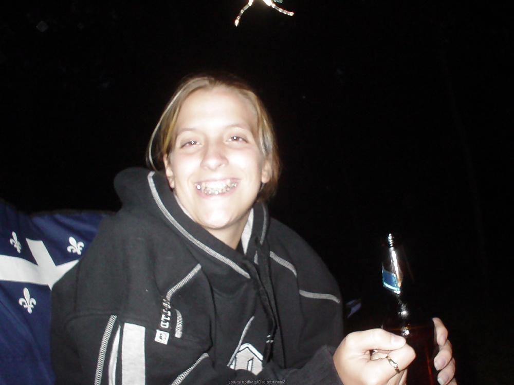 25P Guys Braces Girlfriend 
