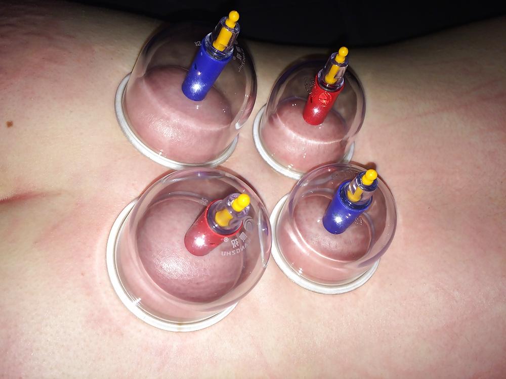 5P Japanese suction cups massage therapy 