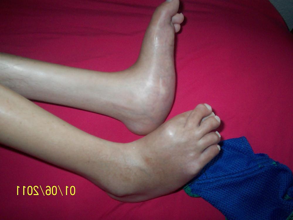 10P Pretty feet