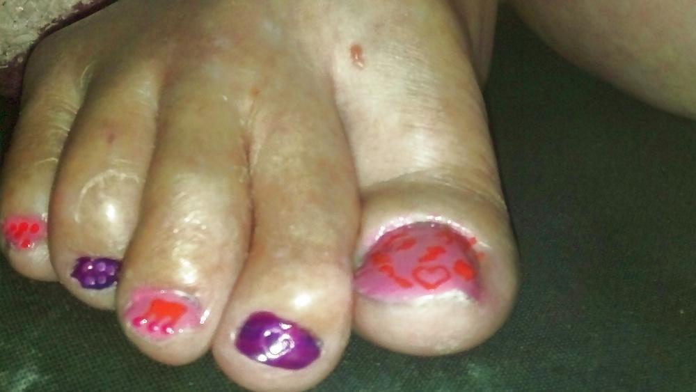 10P Pretty feet