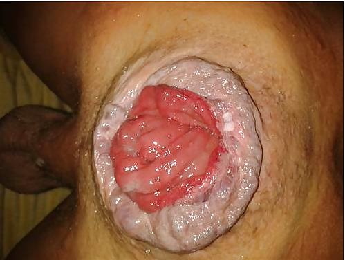 16P Big male cunt