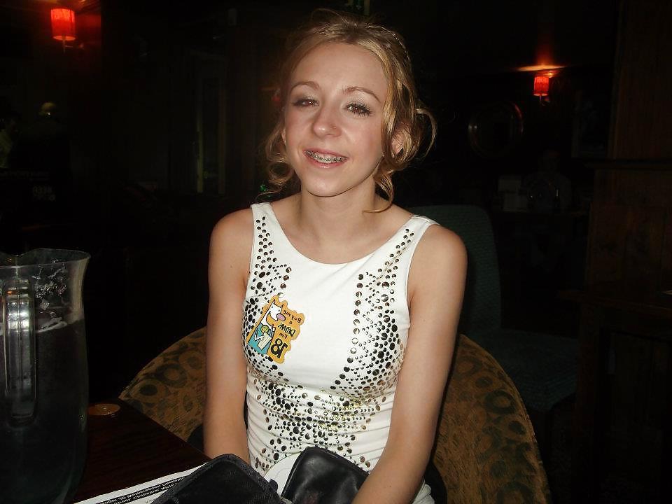 7P Me with my Braces :-( 