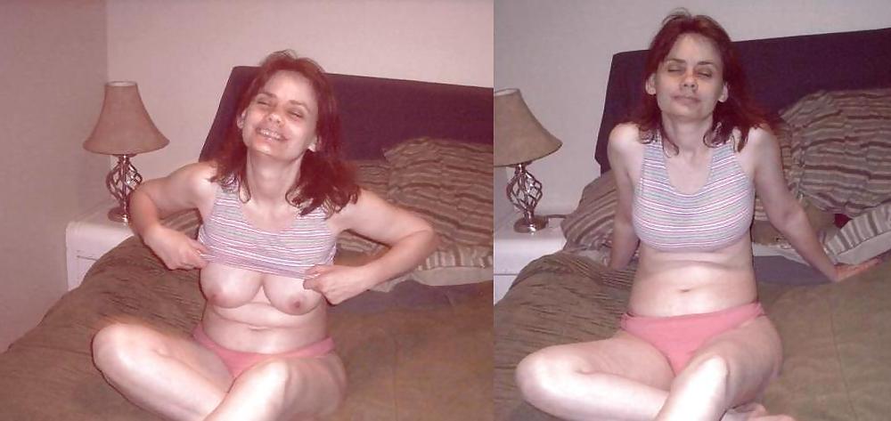 20P Before and after Gallery
