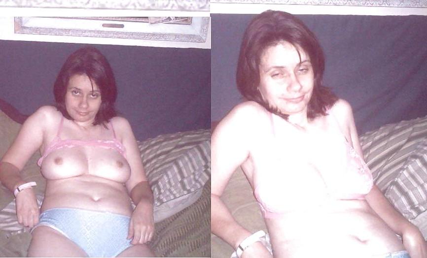 20P Before and after Gallery