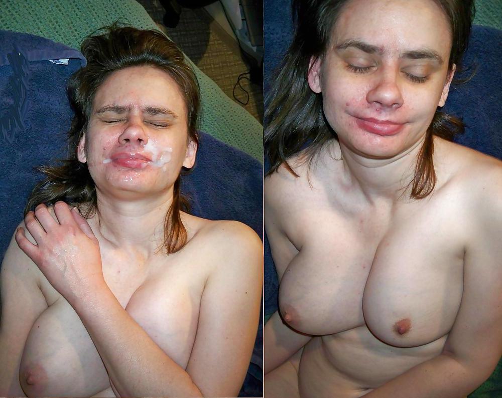 20P Before and after Gallery