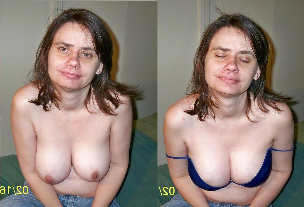 20P Before and after Gallery