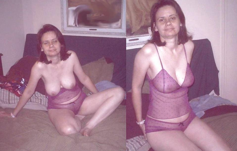 20P Before and after Gallery