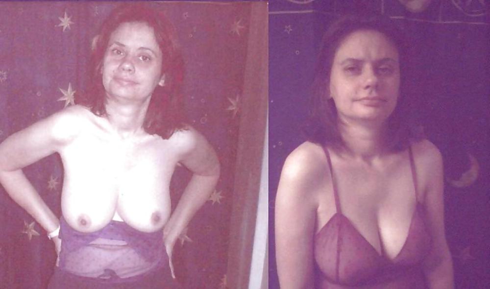 20P Before and after Gallery