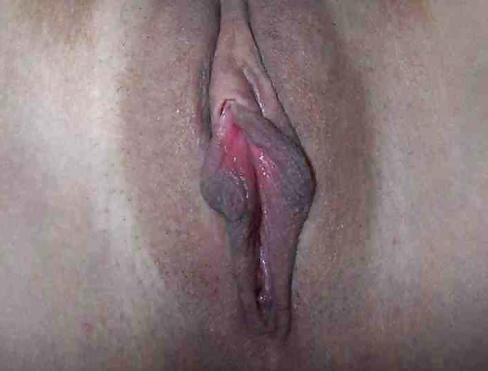 25P Big Pussy Lips, Clits, Large Labia (45)