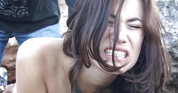 11P Anal pain