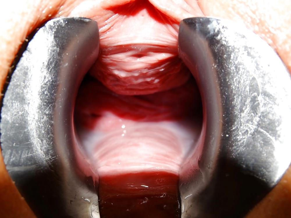 21P My girlfriend stretching and speculum insertions