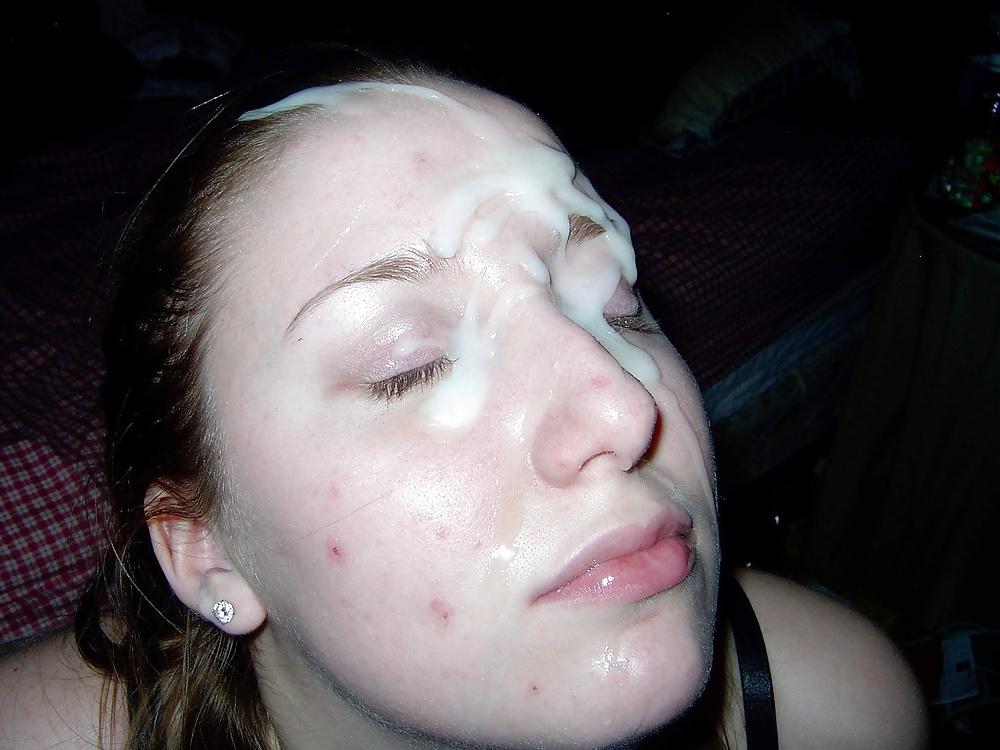 11P Acne Girls Need Cum on Their face 