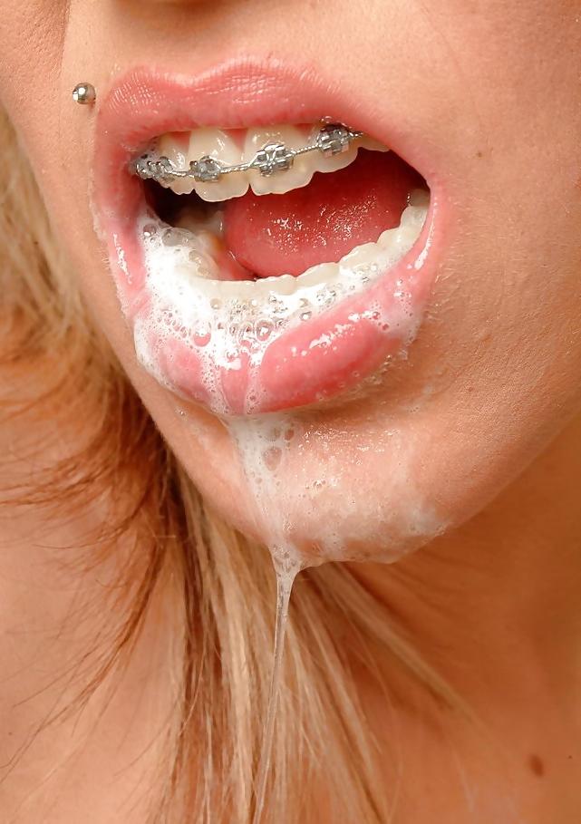 5P Girls with Braces Cumshot