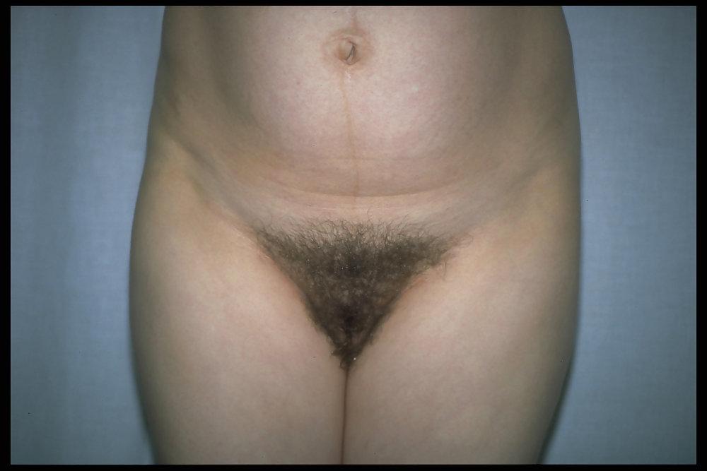 6P Hairy pregnant women 4