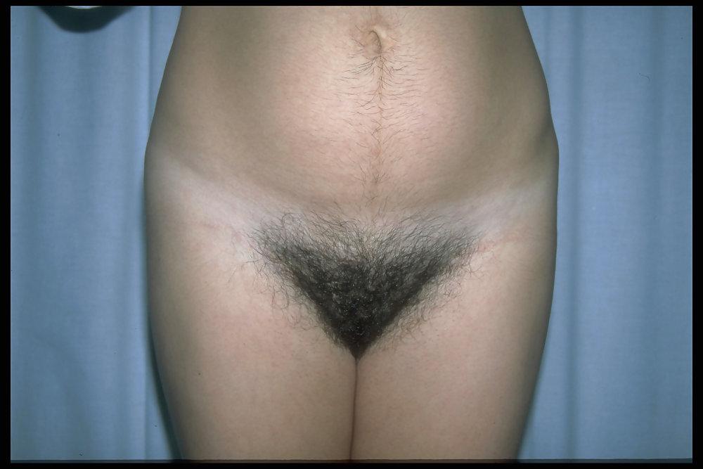 6P Hairy pregnant women 4