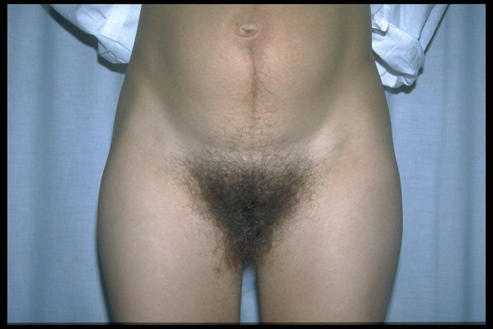 6P Hairy pregnant women 4