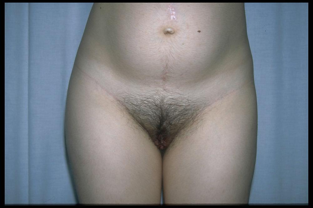 6P Hairy pregnant women 4