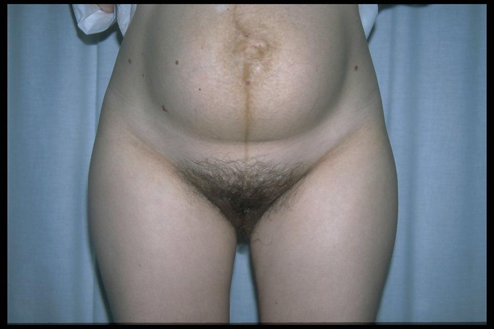 6P Hairy pregnant women 4