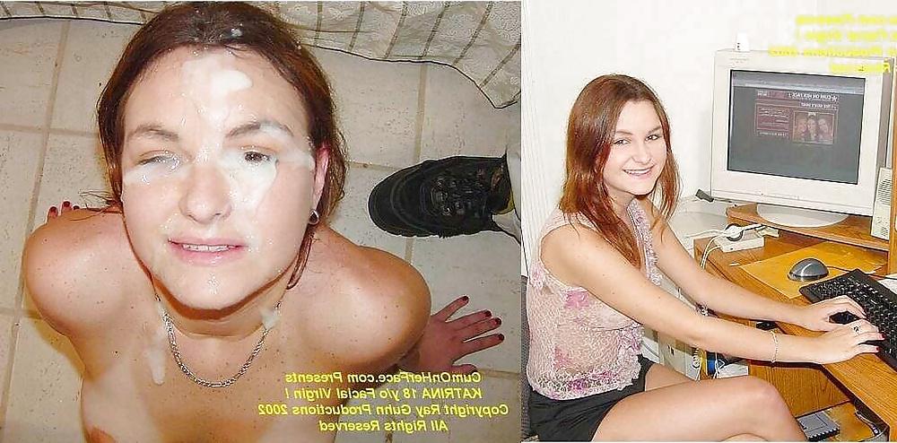25P Before and after