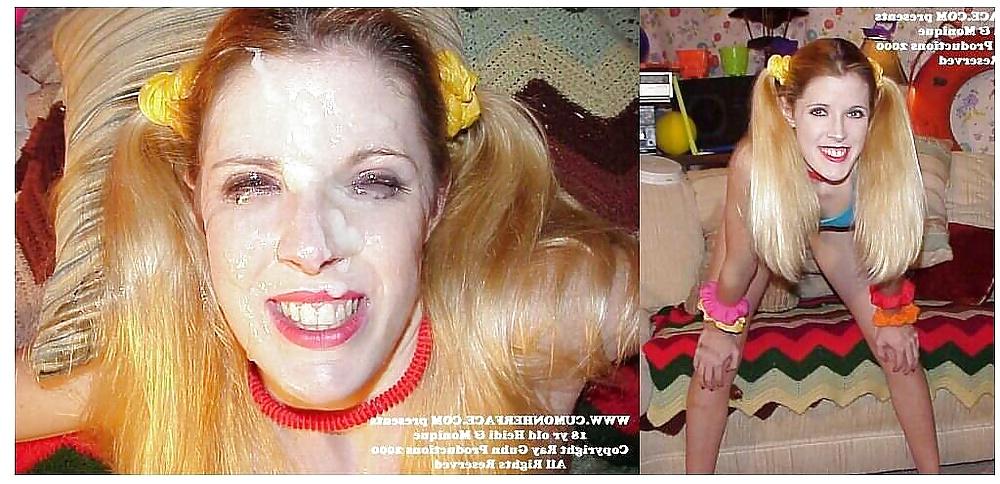 25P Before and after