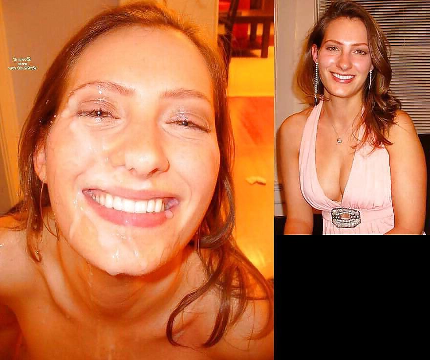 25P Before and after